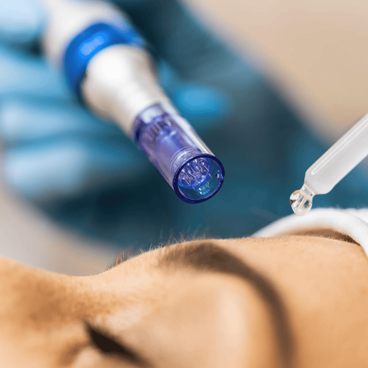 Instrument de masaj facial SHEIN, mix culori